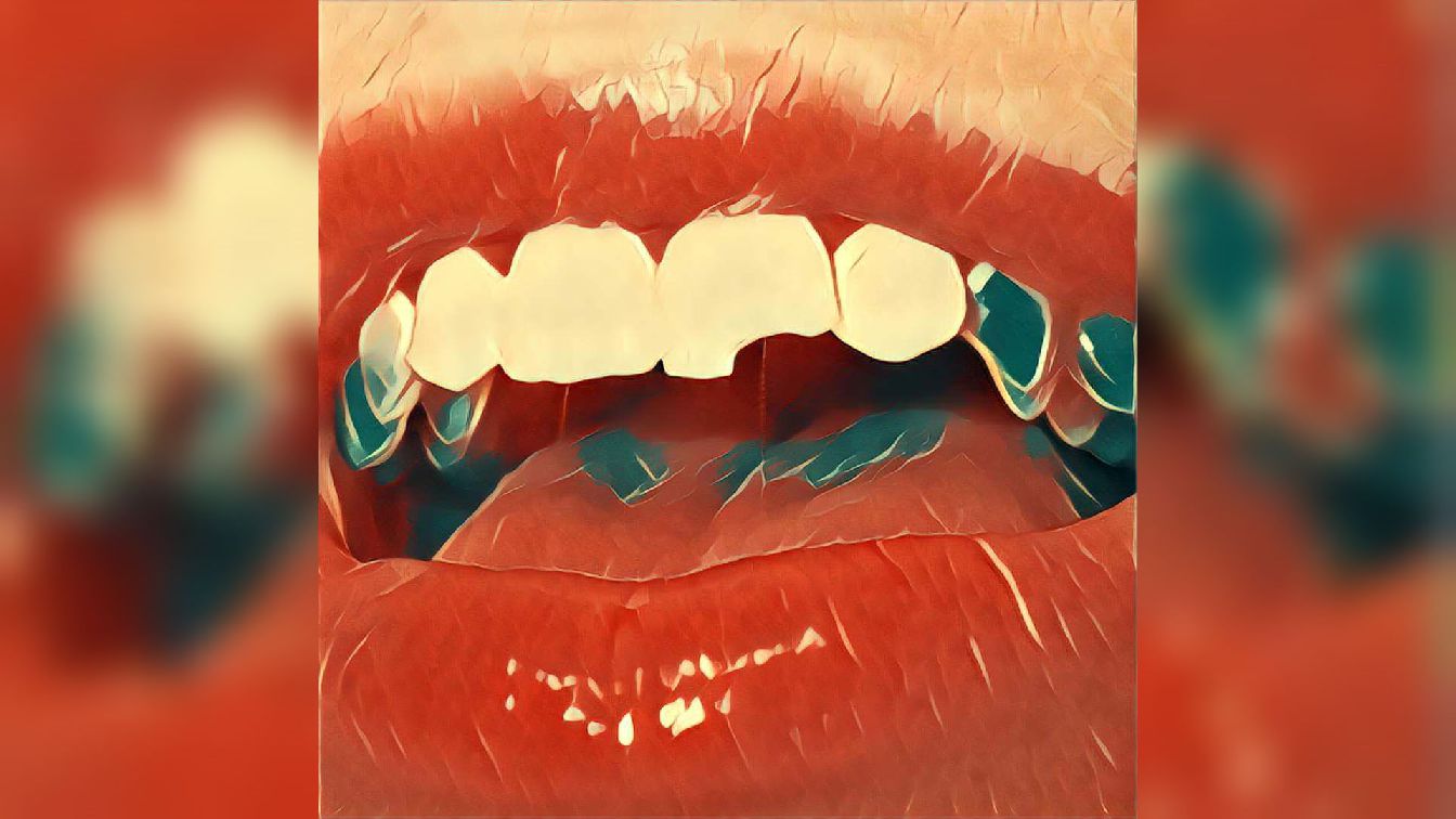 Abgebrochener Zahn Traum Deutung