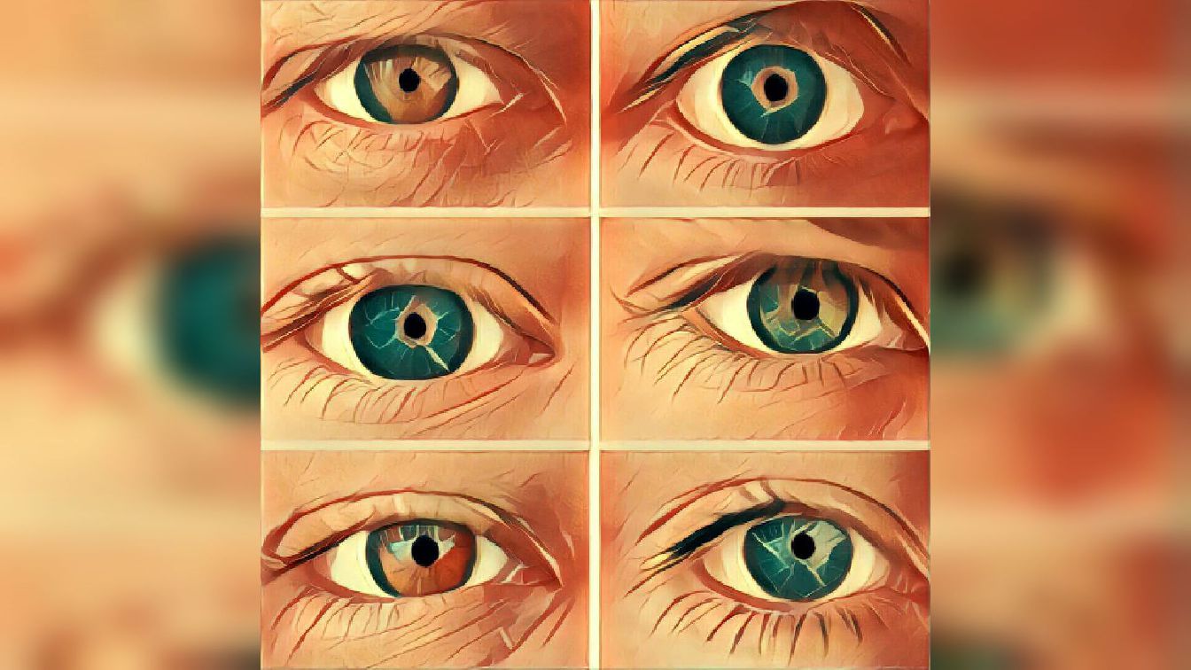 Augen unterschiedlich große Große Pupillen